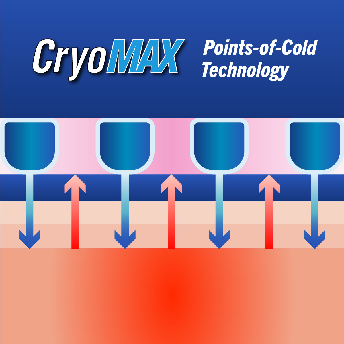 Cryo-Max Cold Pack, 8 Hour Reusable Cold Therapy Ice Pack for Elbows, Knees, Neck + More, Medium, 6" x 12" (1 Count)