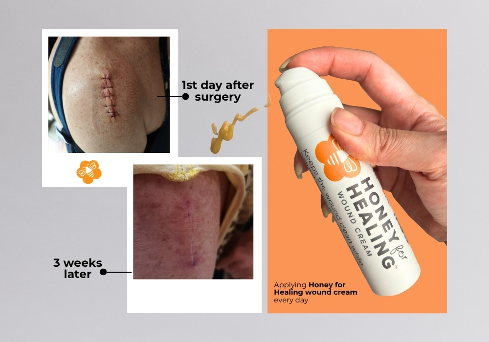 Manuka Honey Wound Cream – Non-Sticky, Fast-Absorbing First Aid Skin Care for Minor Cuts, Burns, Scrapes & Blisters – 1.75 oz
