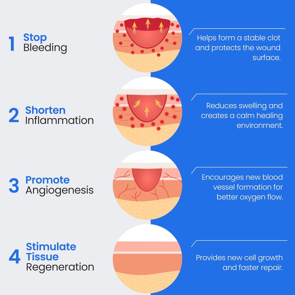 collagen-pads-for-wounds-4-x-4-5-count-b-71R-7Q8EigL.jpg