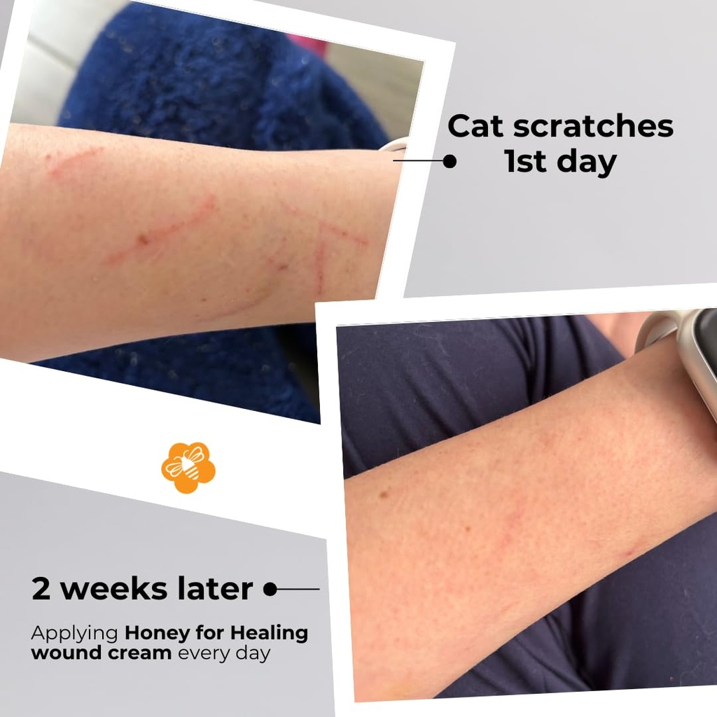 manuka-honey-wound-cream-non-sticky-fast-61fbJBdESnL.jpg