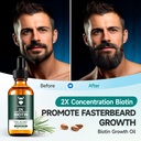 beard-growth-oil---2x-concentration-biot-2.jpg