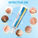 healmusz-toe-nail-fungus-ointment-antifu-3.jpg