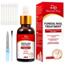 Toe unghii Fungus Tratamente pentru unghii: unghii Fungus Tratamentul pentru unghii 