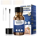 Tratament de unghii Fungus,Foot Fungus Tratament suplimentar,Fungus Nail Tratamente, unghii unghii Fungus Tratamente pentru ciuperci unghii galben unghie unghii tratament (1fl oz/30ml)