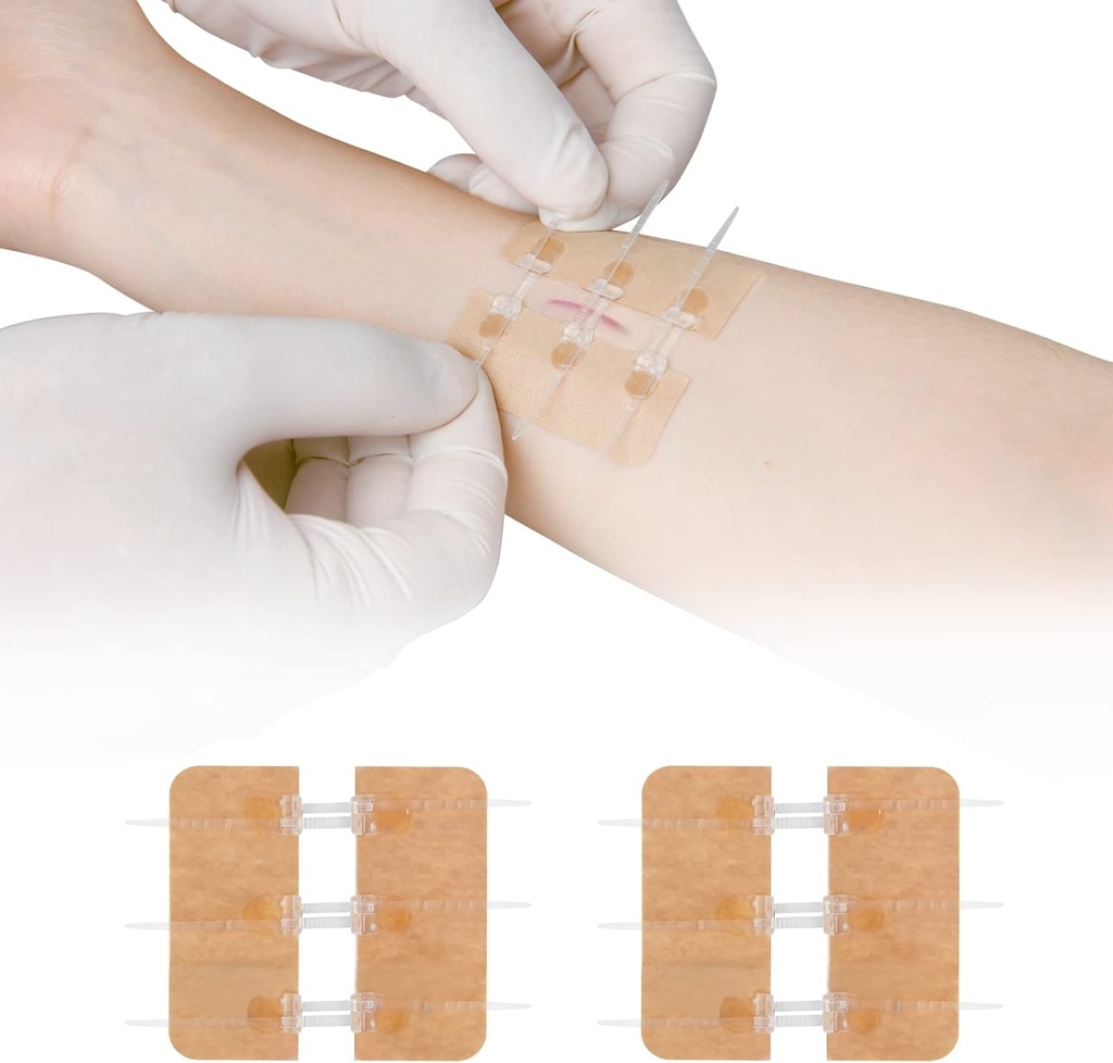 Zip Stitch Laceration Repair without Butterfly Bandaids Quick Clot - Urgente Wound Closes Device 2 Pieces (PU)