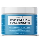Scalp Soothing Cream for Flaking Skin, Temporar Relief of The Look of Dry Red Skin, 100ml