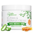 Wild Naturals Eczema si Psoriazis Crema pentru uscat, Itchy Skin 