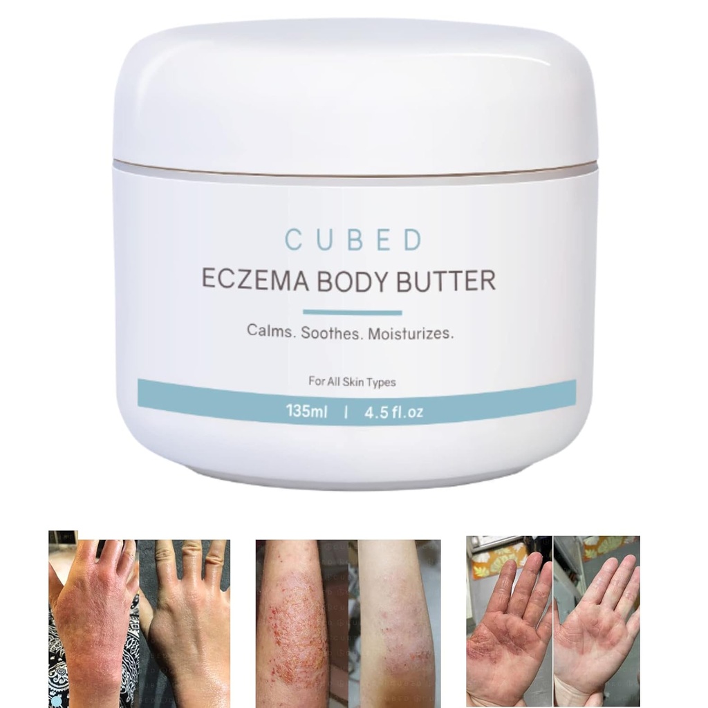 Cub 4.5 oz Eczema Cream pentru adulți, Eczema Relief, Eczema Tratamentul, Historitizarea pielii uscate Iridate, Loțiune inteligentă pentru simptome de retragere topice steroizi, Psoriazis & Rosacea, Eczemă, Dermatită