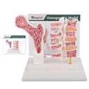Ultrasist Human Anatomy Osteoporoză Model, Vertebrae Anatomic Schelet Model cu Card de studiu pentru studentul de predare Demonstrație
