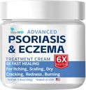 Bio-MD Psoriazis Crema Eczema, Crema Eczema pentru adulţi, Reapariţia controlului rezistenţei suplimentare, Simptoma de rezistenţă, Eficient pentru Dermatita Seboreică, Tratamentul Foliculitei