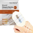 Suturi Bandaje adezive 2 PCS Laceratie chirurgicala Reparatie fara coasere rapida Wound Wound Device