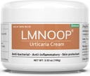 Urticarie Cream, Hives Relief Advanced Formula pentru mâncărime, înroşire, cosuri, Erupţii cutanate, Edem şi alte simptome ale pielii