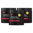 iRestore Advanced Hair Creștere Supliment pentru femei, Vitamine de păr pentru creșterea mai rapidă a părului, Cel mai bun pentru pierderea părului și înălțare - 1 lună de aprovizionare Fiecare - 30 Conte (Pachet de 3) - Negru