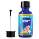Tratament Fungus unghie extra-Forţă - unghii Fungus Tratamentul pentru unghii - unghii Fungus Tratament extra- Putere - unghii Fungus (30ml)