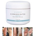 Cub 4.5 oz Eczema Cream pentru adulți, Eczema Relief, Eczema Tratamentul, Historitizarea pielii uscate Iridate, Loțiune inteligentă pentru simptome de retragere topice steroizi, Psoriazis & Rosacea, Eczemă, Dermatită