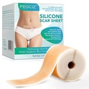 Silicon Cicatrice foi, Silicon Cicatrice bandă, Silicon foi pentru cicatrici, Scară Away Silicon foi pentru Face, Acnee, Keloid, Burns, Marca de stretch, C-Secțiunea Scara chirurgicala eliminarea (1.6" x 60"Roll-1.5M)