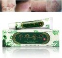 Oversea Mii de ani Cremă de plante Eczemă de plante, Creme de psoriazis Dermatită şi Eczemă Prurit Psoriazis JIULIN