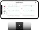 AliveCor KardiaMobile 6-Lead Personal EKG Monitor 
